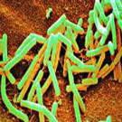 B. Subtilis dyed green as viewed under a microsope. Looks like a pile of longer tubes.