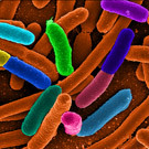 E. Coli, dyed, as viewed under a microsocope. A pile of short tubes.