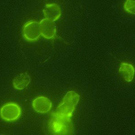 Cryptosporidium under green light viewed through a microscope. Floating green bubbles with faint tails.